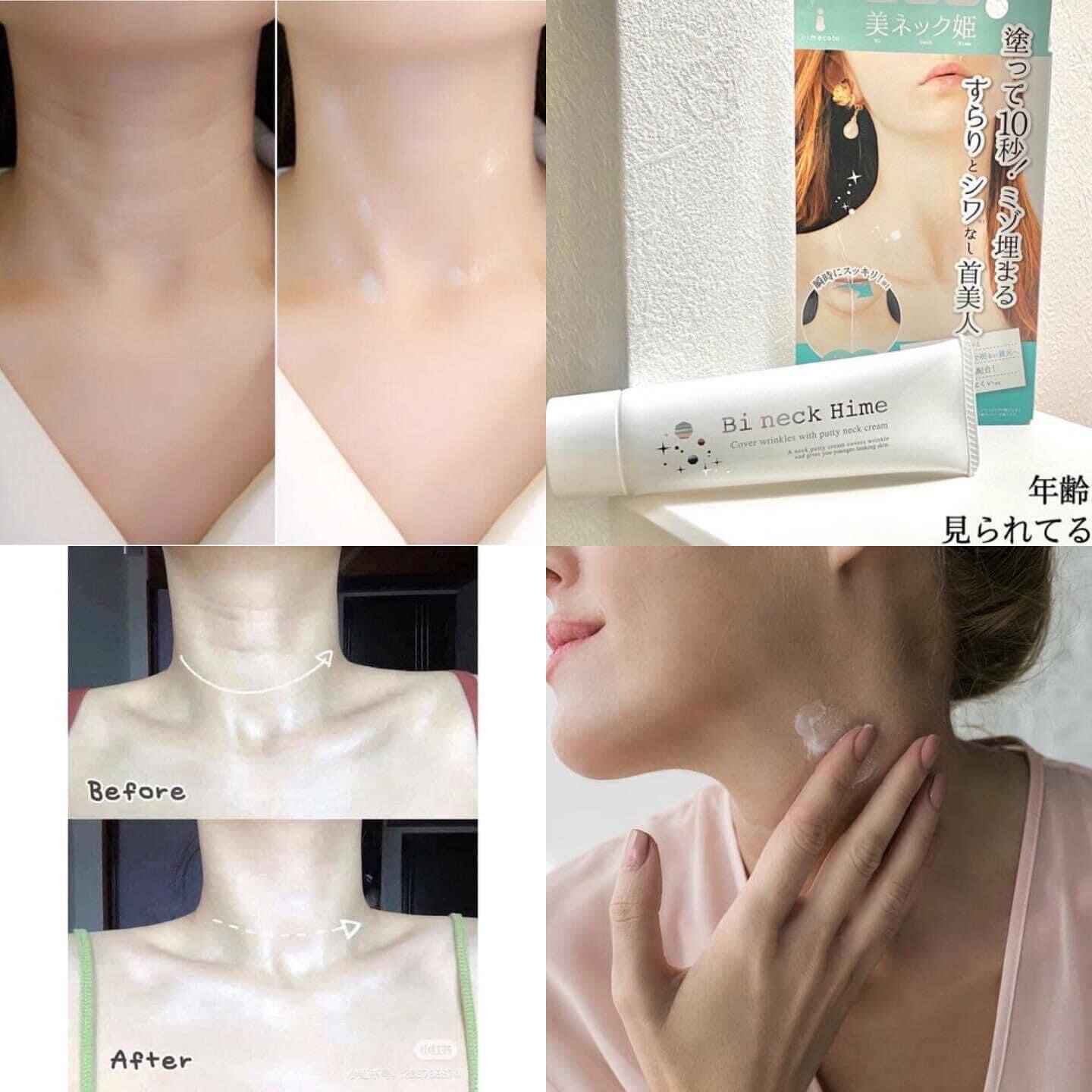 KEM DƯỠNG TRẮNG CỔ