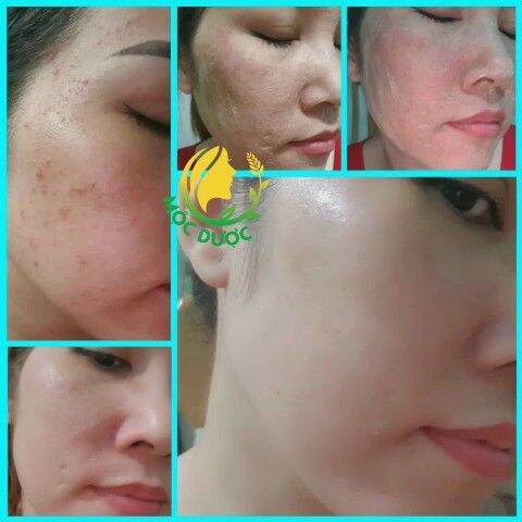 Serum tái tạo Mộc Dược 100ml