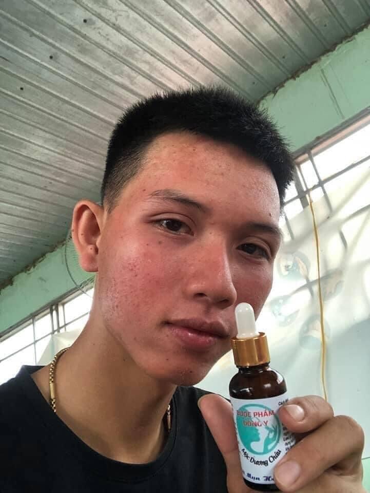 TÁi TẠO DA MỘC DƯƠNG CHÂU 30ML