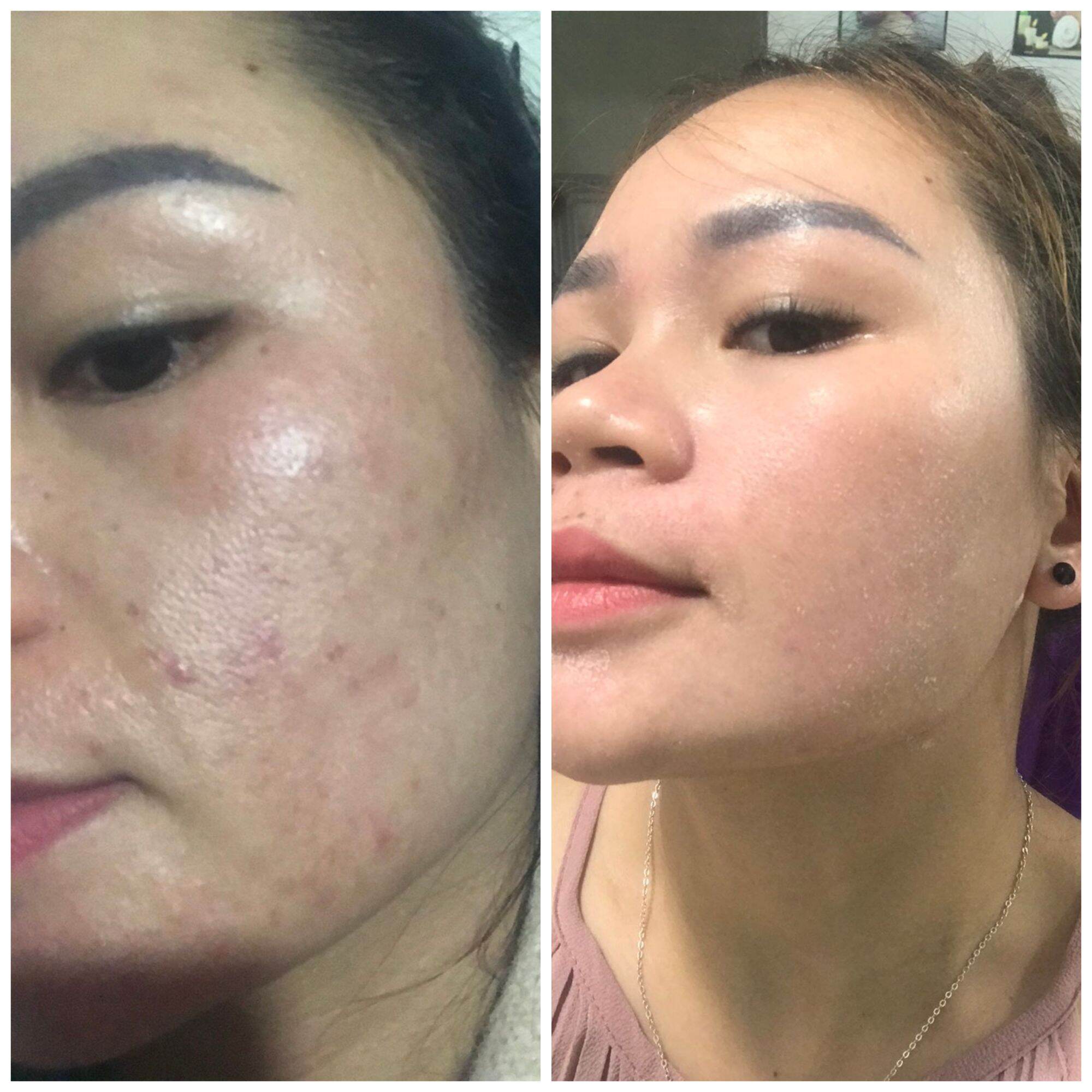 Đông y Sắc Ngọc Nữ tái tạo da