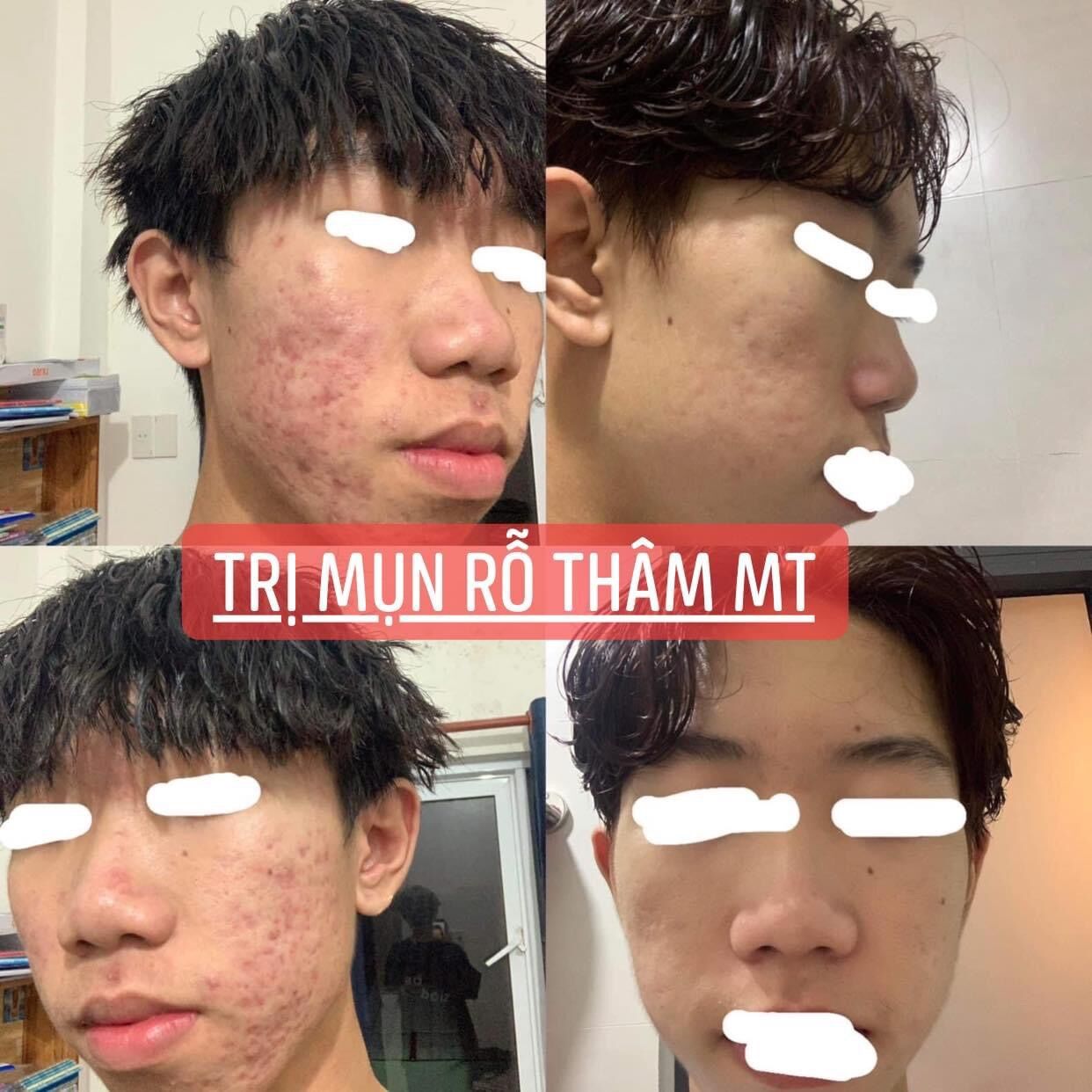 Thảo dược nhân sâm tái tạo(giá sỉ tại xưởng từ 450ml )handmade(loại chuẩn)