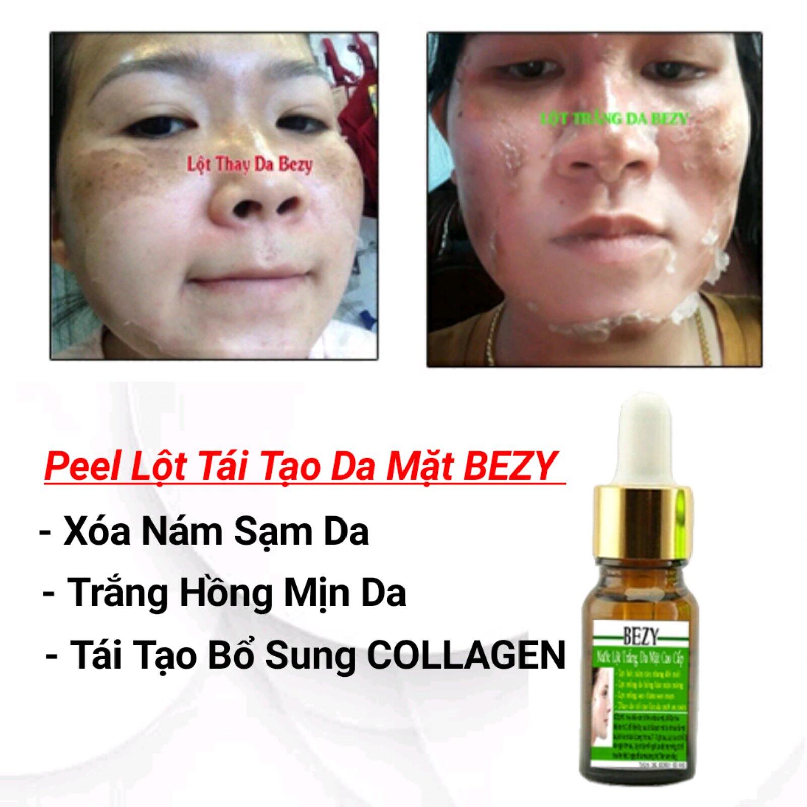 Peel Da Mặt Xóa Nám Sạm Tàn Nhang Trắng Da Bezy