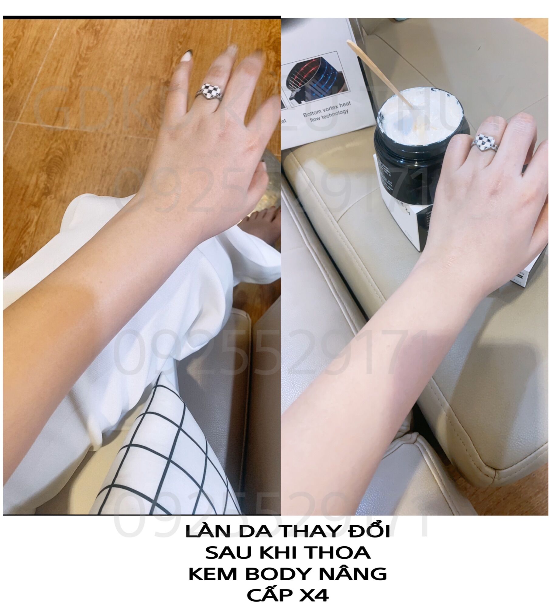 KEM BODY X4 DƯỠNG TRẮNG DA ENNY