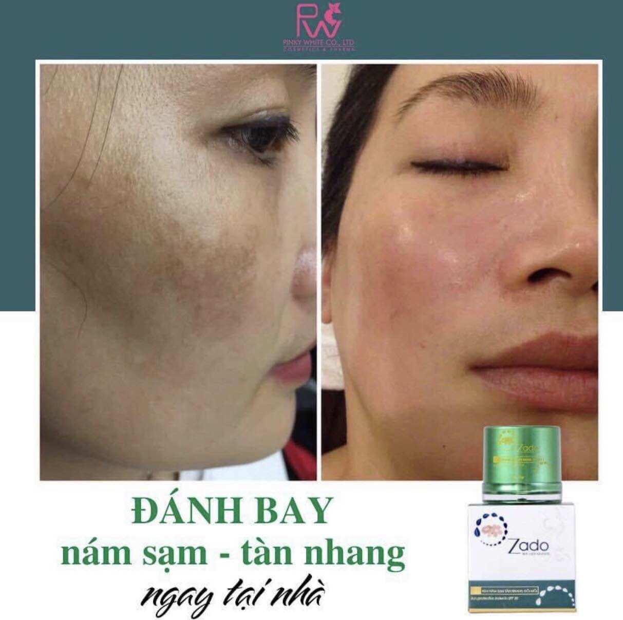 Kem Zado Nám Sạm Tàn Nhang Đồi Mồi ,12gram
