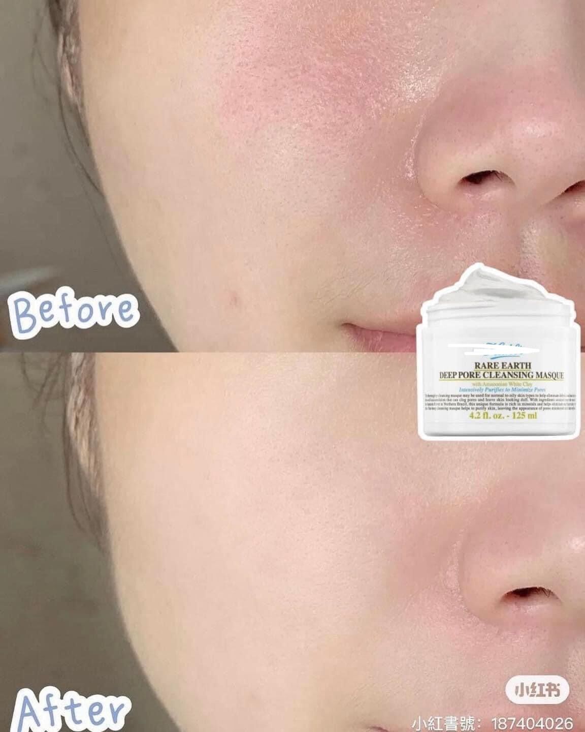 MẶT NẠ ĐẤT SÉT KIEHL VHL REVIEW 10/10