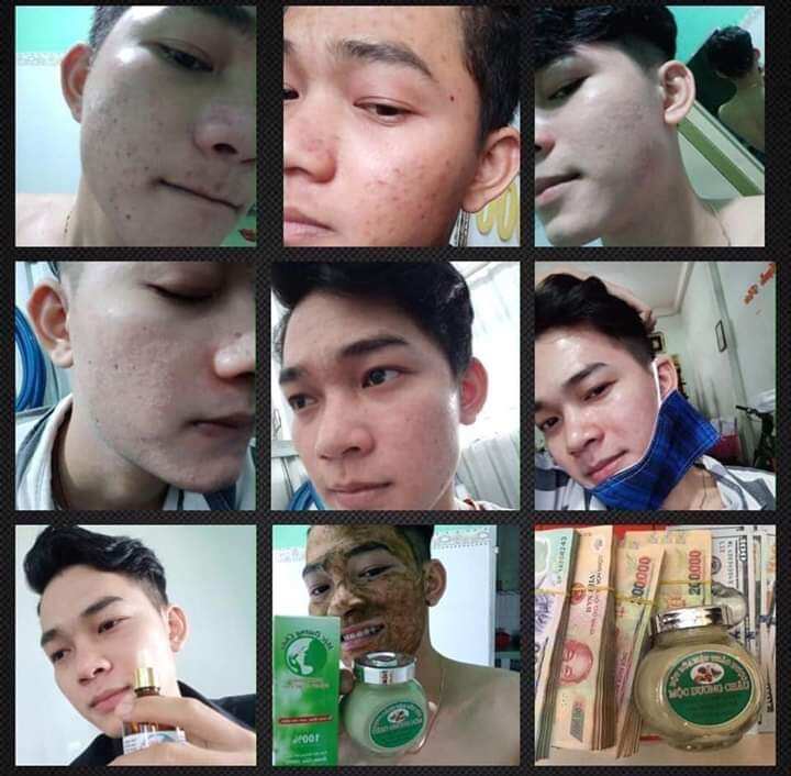Dược Phẩm Đông Y Mộc Dương Châu 30ml