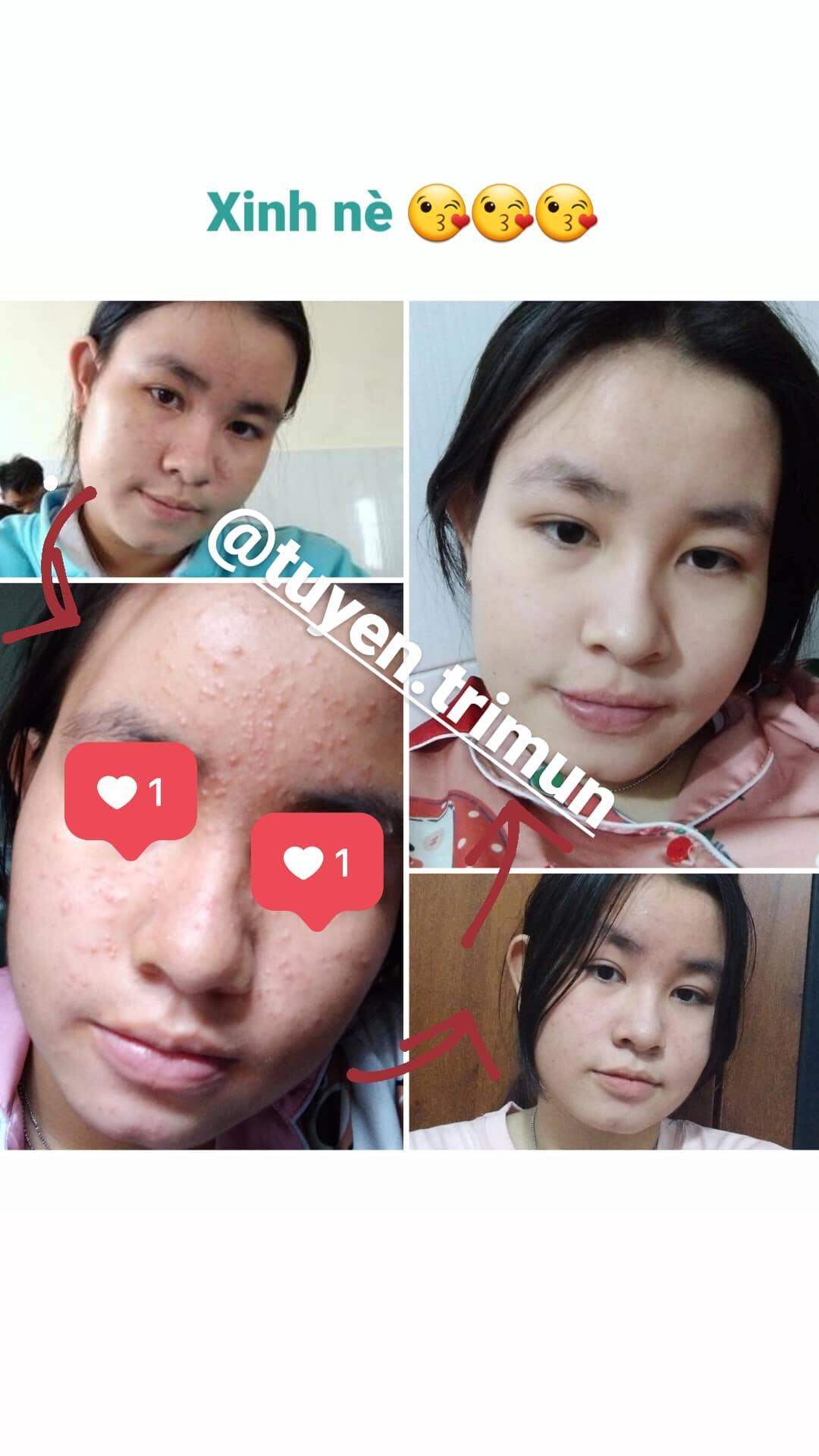 Đông y Sắc Ngọc Nữ tái tạo da