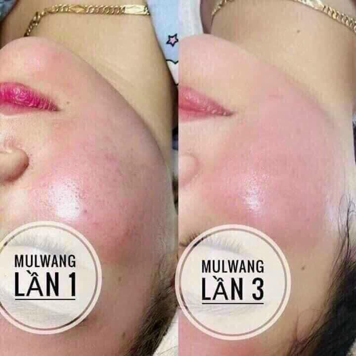 Mulwang x5 căng bóng da Hàn Quốc