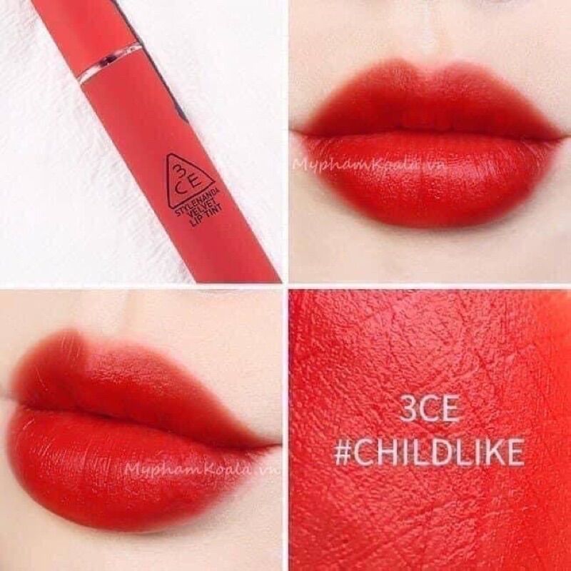 𝐒𝐨𝐧 𝟑𝐂𝐄 - 𝐂𝐡𝐢𝐥𝐝𝐋𝐢𝐤𝐞 Đỏ 𝐂𝐚𝐦 𝐬𝐢ê𝐮 đẹ𝐩