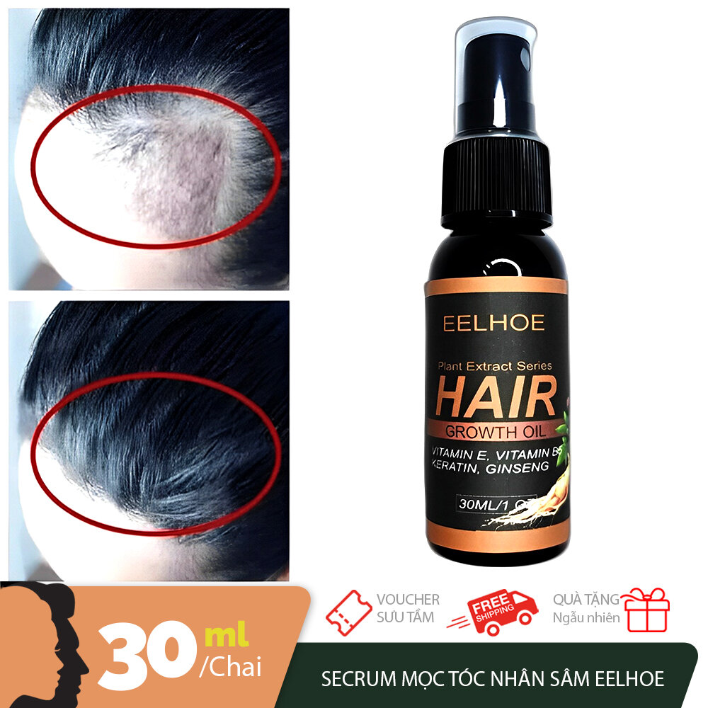 Xịt mọc tóc nhân sâm EELHOE giảm rụng tóc, kích mọc tóc, cải thiện hói đầu, ngăn nấm da đầu 30ml