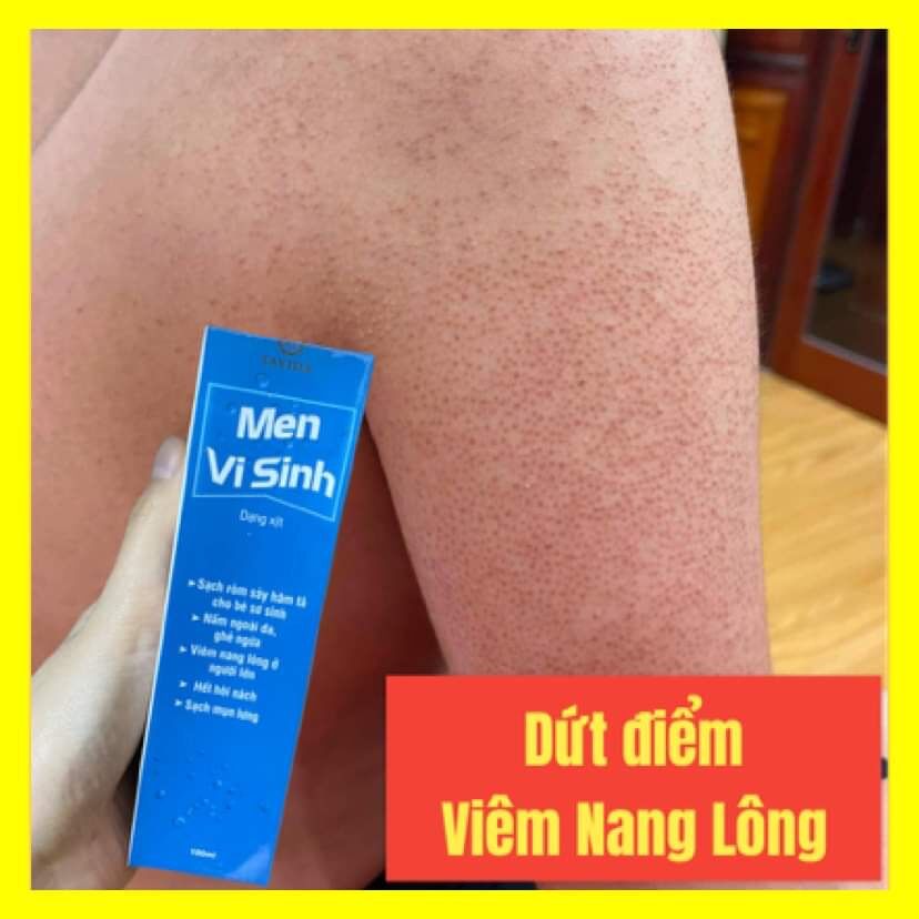 TẠM BIỆT VIÊM NANG LÔNG - MỤN LƯNG, NGỰC CÙNG LIỆU TRÌNH MEN VI SINH TAVIDA *dùng xịt ngày 2-3 lần *