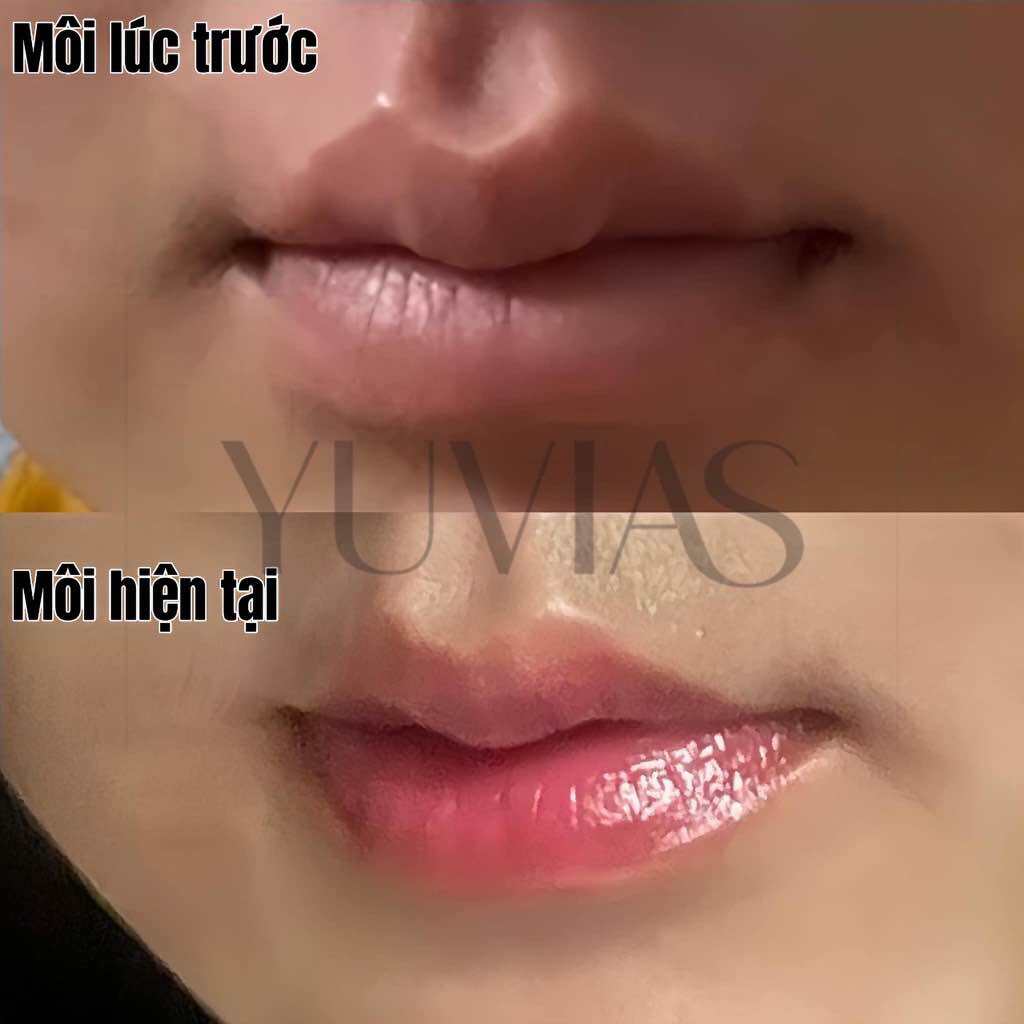 Tinh chất khử thâm YUVIAS căng bóng mịn màng, tinh chất làm hồng sáng da cấp ẩm môi tặng son dưỡng ẩm môi 10ml