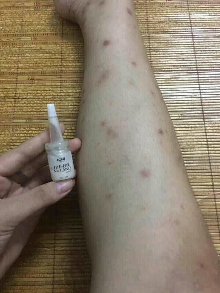 SERUM JIUHE THÂM BYE BYE MELANO THANH TÔ