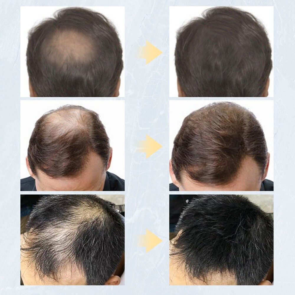 Bột Phủ Tóc Làm Dày, che Hói Toppik