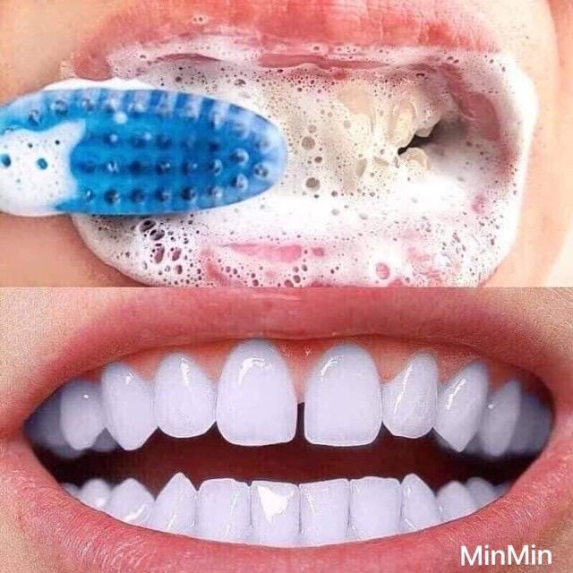 Kem Đánh Răng Crest complete Extra Whitening Scope Advanced Freshness 232g Của Mỹ