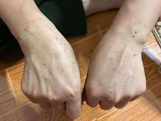 Gel tẩy tế bào chết nhân sâm Arrahan Hàn Quốc