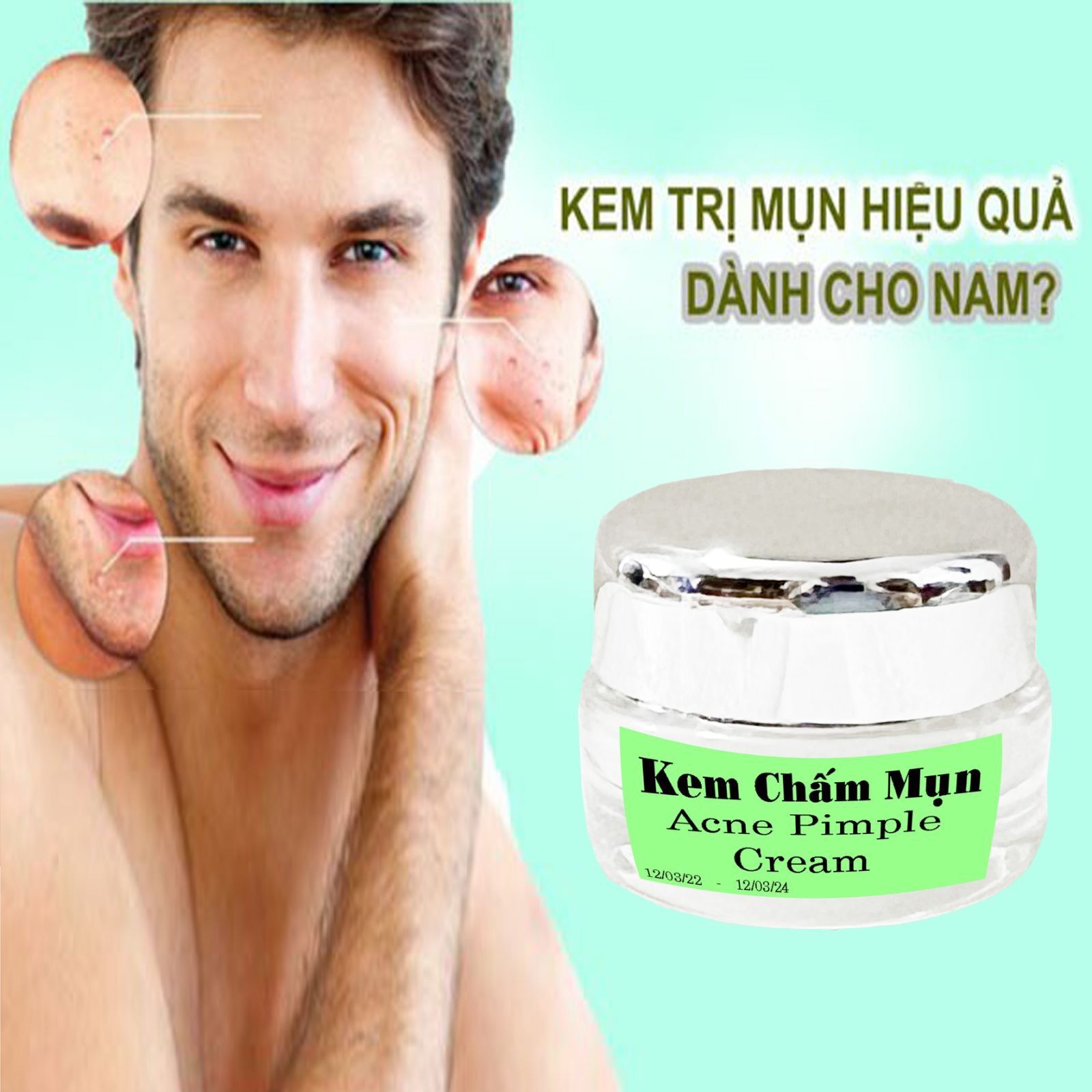Kem Chấm Mụn Xẹp Nhanh Mụn Bọc,Mụn Viêm