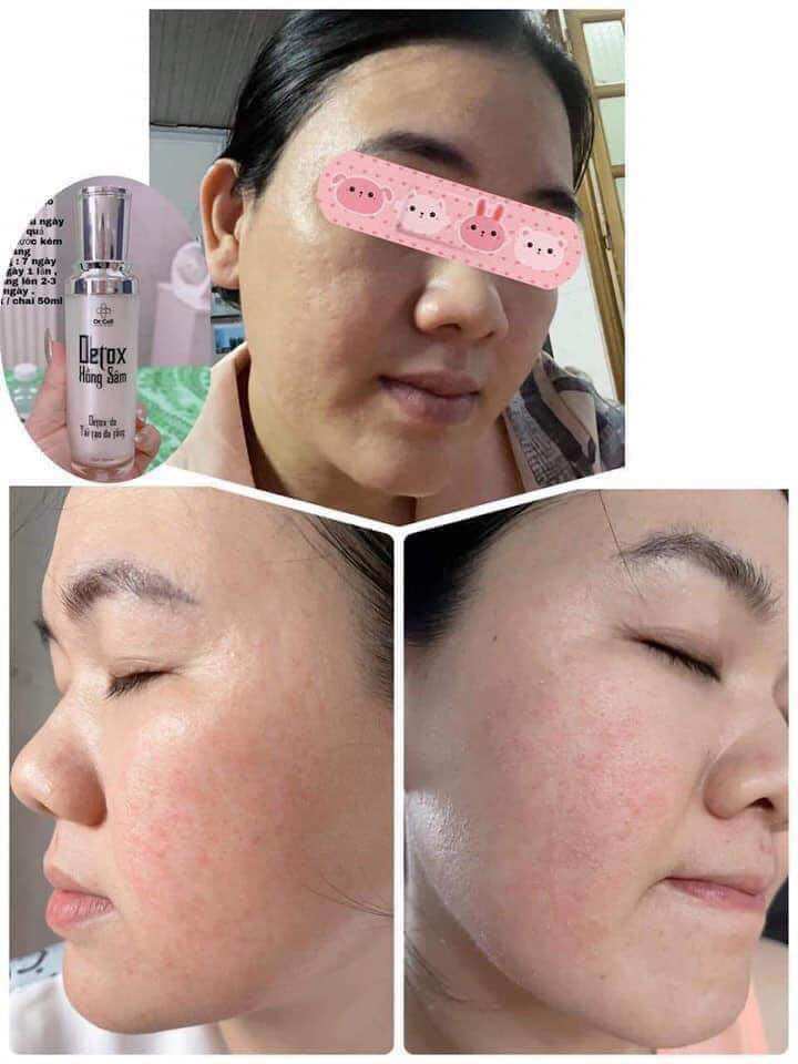 Detox Hồng Sâm DR CELL 50ml