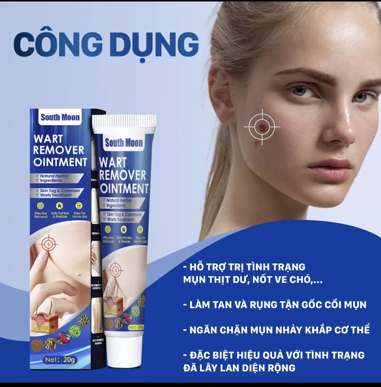 Kem mụn thịt dư cao cấp South Moon, Kem tẩy nốt ruồi, mụn thịt dư, nốt ve chó, u mềm treo, South Moon chính hãng