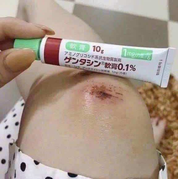 Kem Sẹo Gentacin Nhật Bản