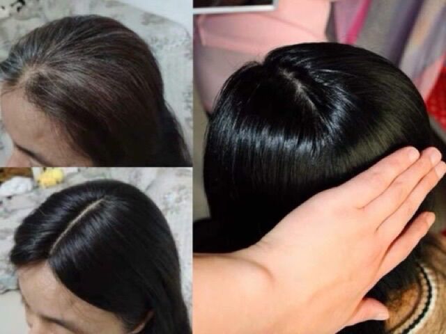 Tóc giả che hói che bạc của nữ ❇️