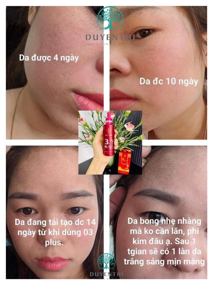 Combo cho da nám Bách y sâm ( nám 03 và cao trắng da)