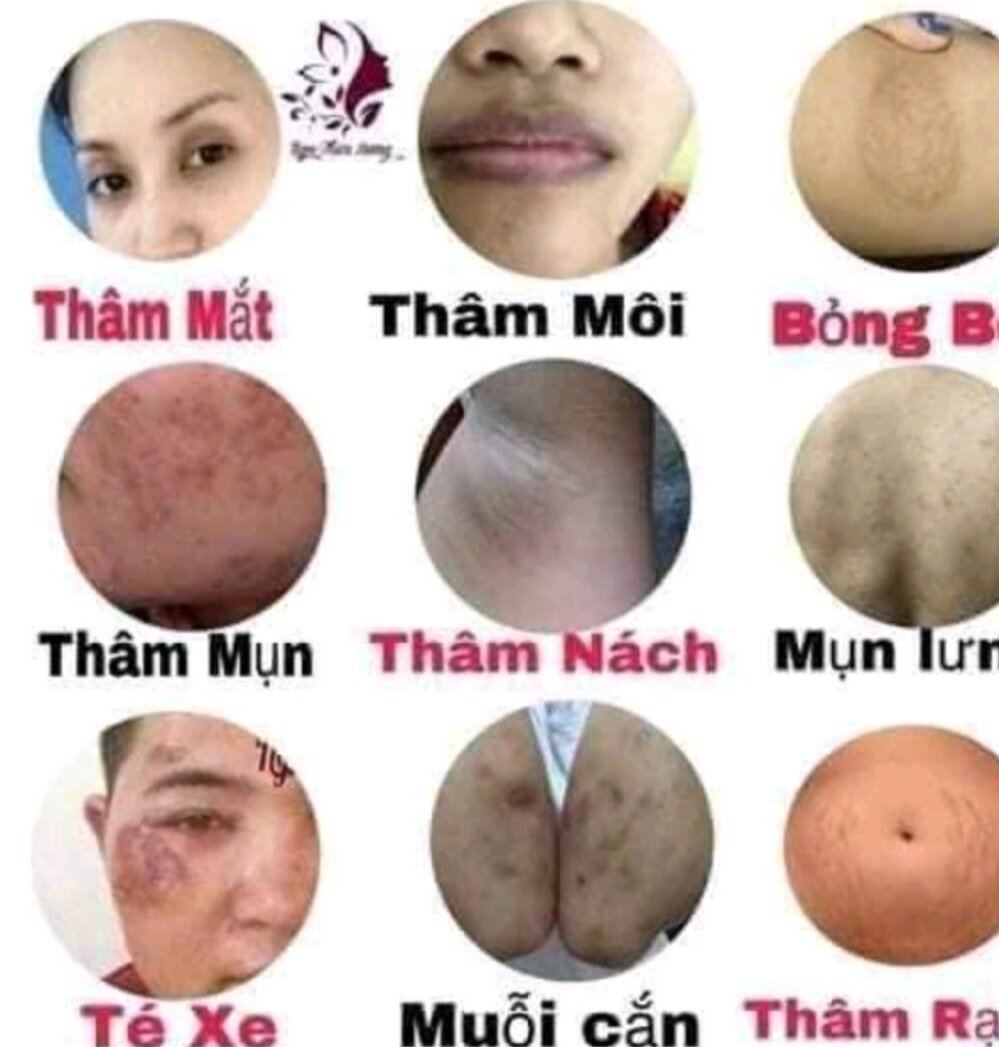 Khử thâm Jiuhe