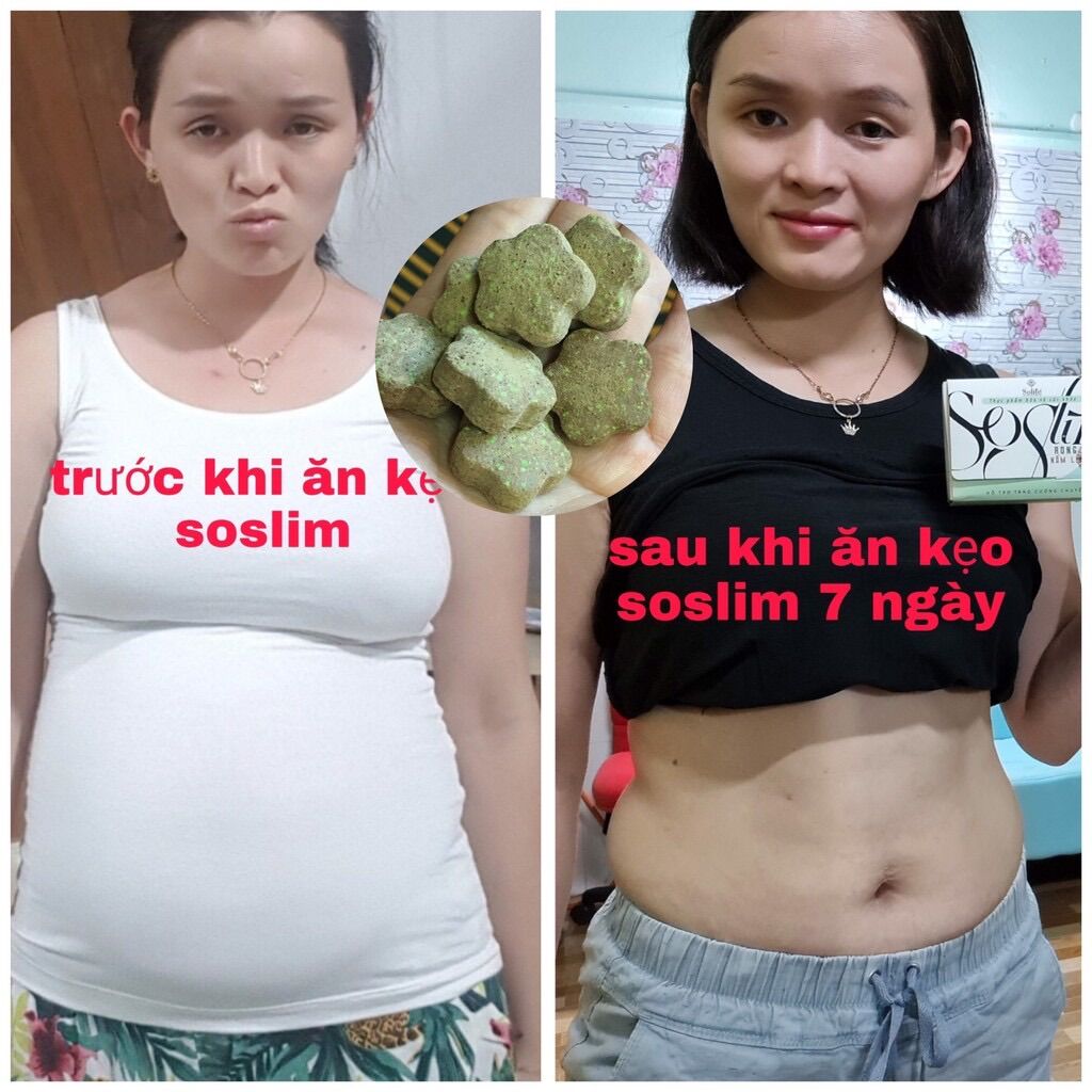Kẹo Socola Giảm Cân Soslim - 15V/hộp