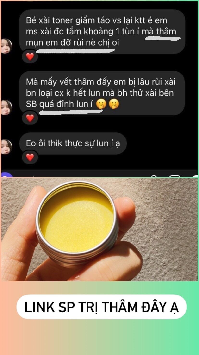 Kem thâm handmade Sunday Beauty