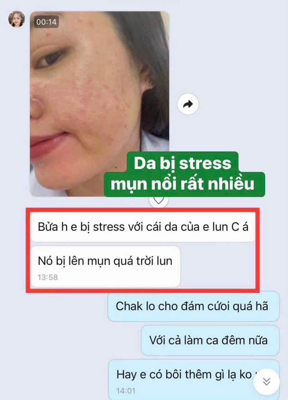 COMBO 3 MÓN SẠCH MỤN IGREEN ( mặt nạ serum và sữa rửa mặt)