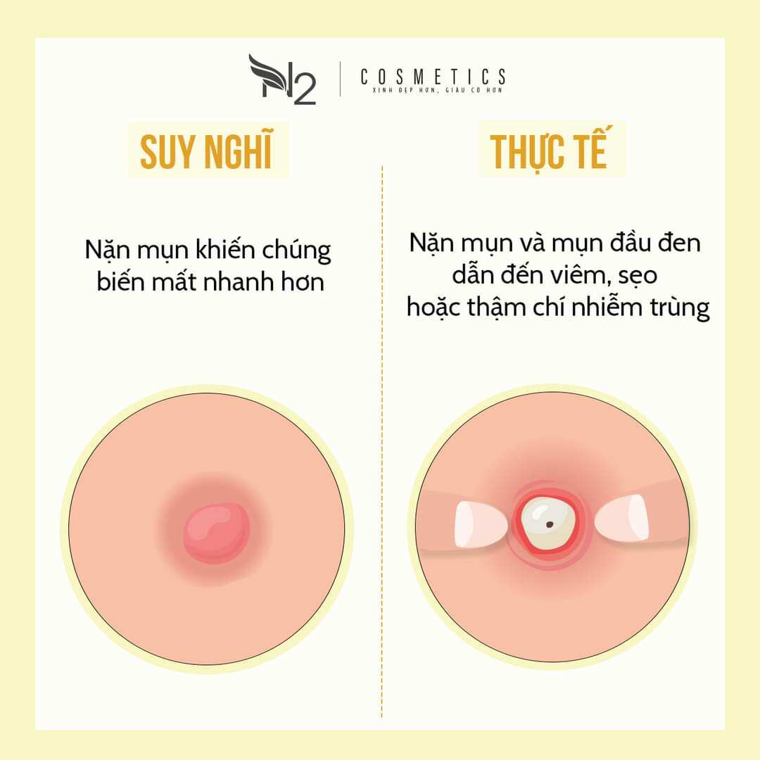 kem n2 cosmetic mụn thâm trắng da n4 18g