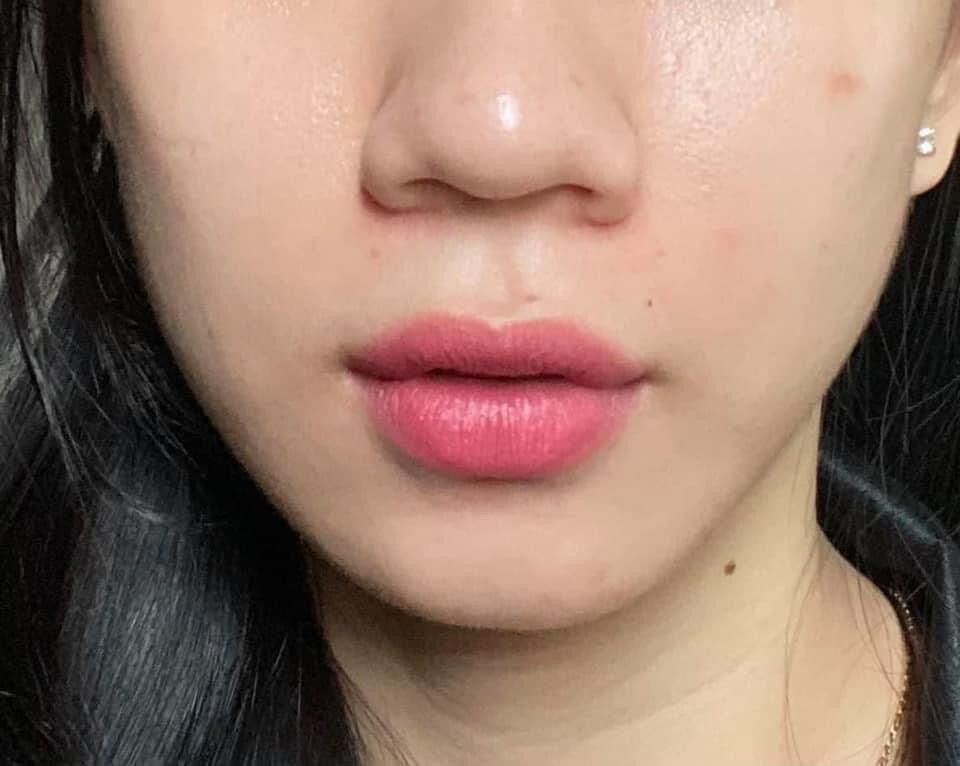 Tinh chất thay da sinh học NeoStrata ProSystem Retinol Peel