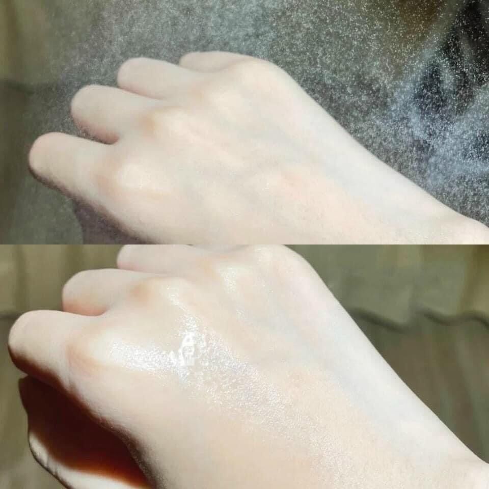 XỊT KHOÁNG VICHY