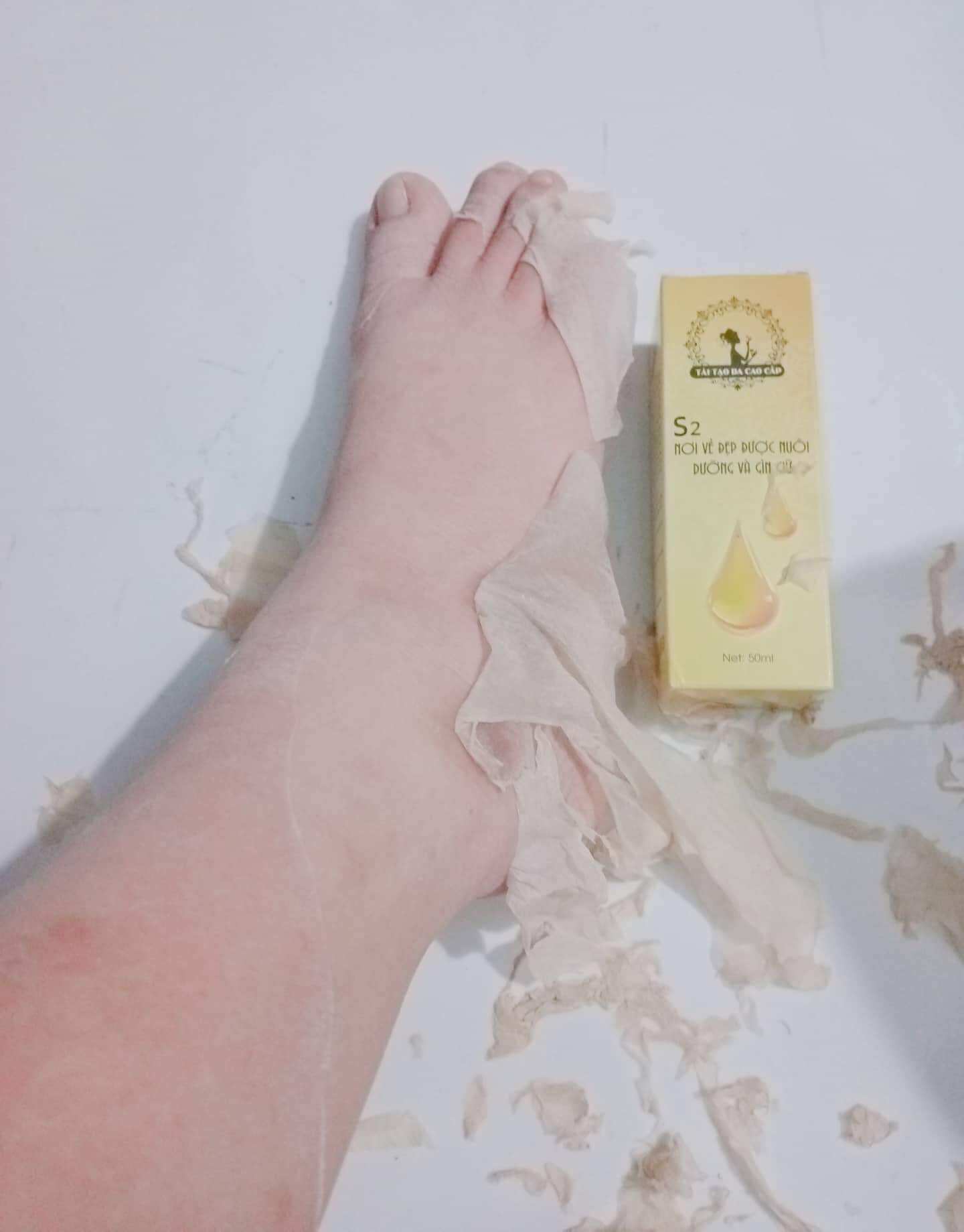 Lột lạnh S2 cao cấp
