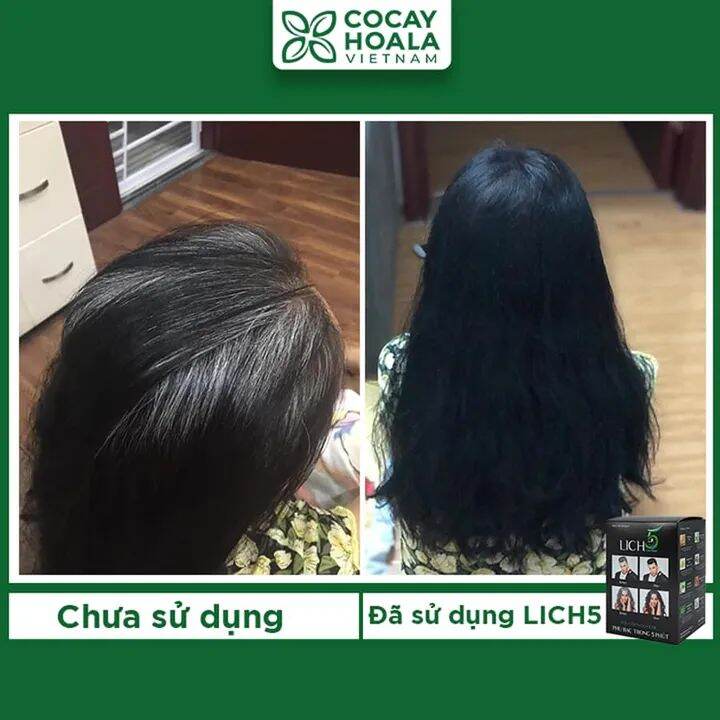 LỊCH 5 DẦU GỘI PHỦ BẠC [HỘP 10 GÓI ĐEN]
