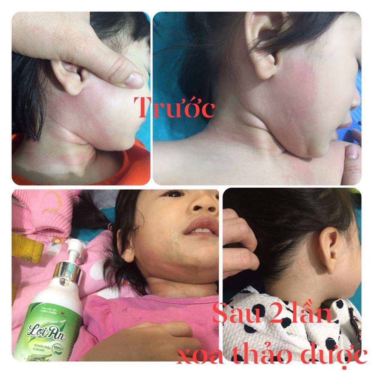 Sữa tắm gội Thảo dược Lợi An