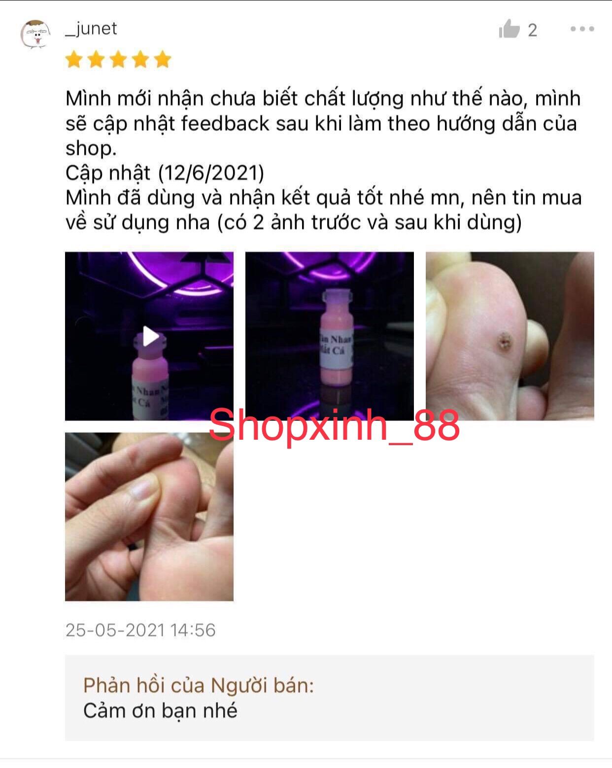 [ Loại Tốt ] Tẩy nốt ruồi , mụn cóc , mụn thịt, tàn nhang, mắt cá, handmade .
