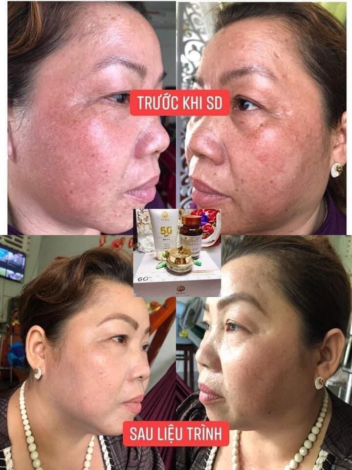 Viên Uống Trắng Da Mờ Nám White+++ Cao Cấp Huna