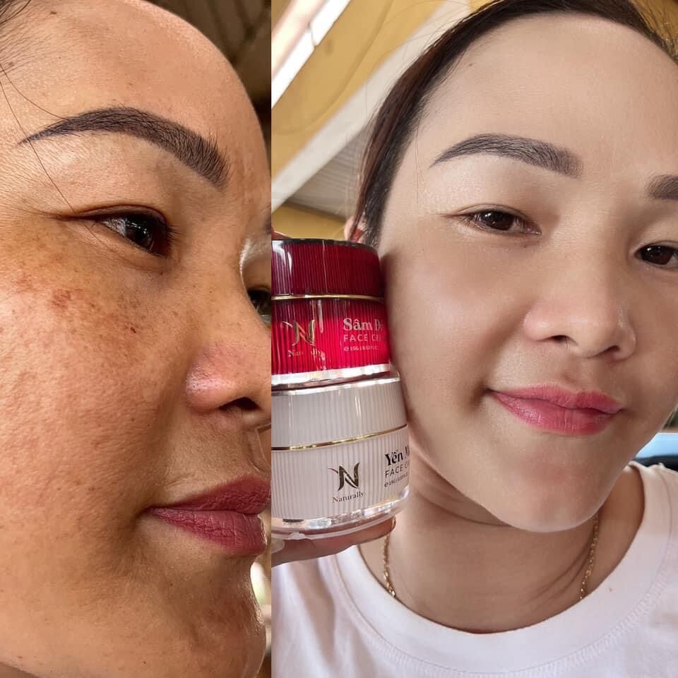 Combo face nám và yến mạch
