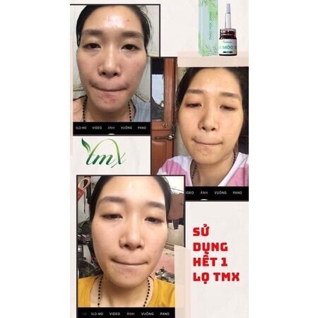 Serum Thảo Mộc Xanh - Chính Hãng 5ml