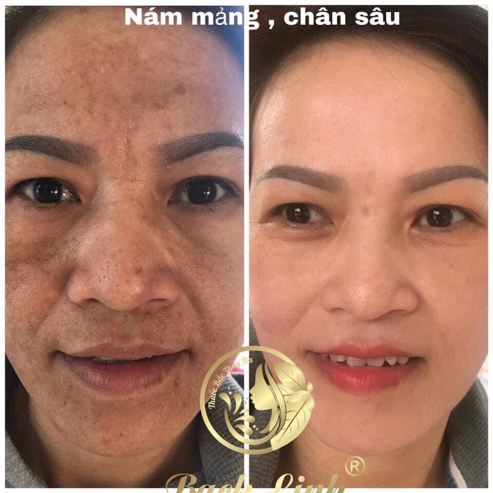 Hồng nhan phấn- bạch linh- bách y sâm(1hộp x 10gói) mẫu mới
