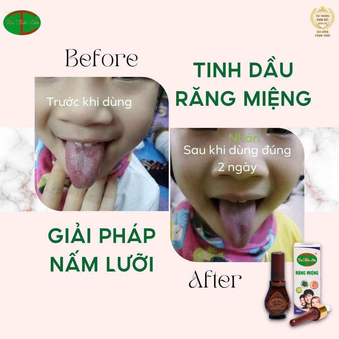 Tinh dầu răng miệng Dạ Thảo Liên 5ml