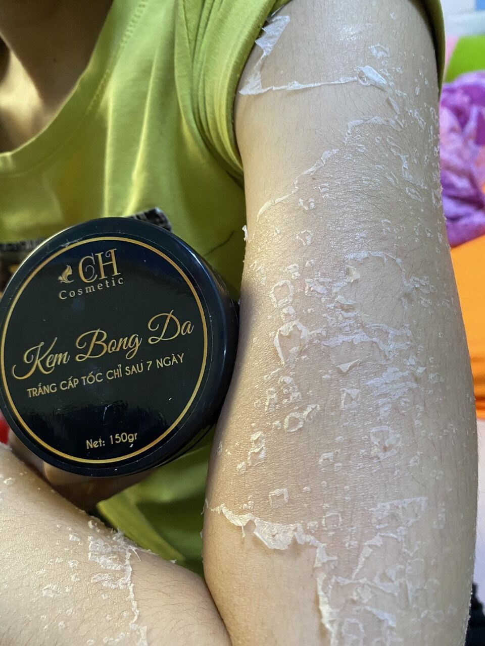 Kem bong da - kem tái tạo da body