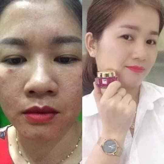 KEM FACE TÍM N COLLAGEN