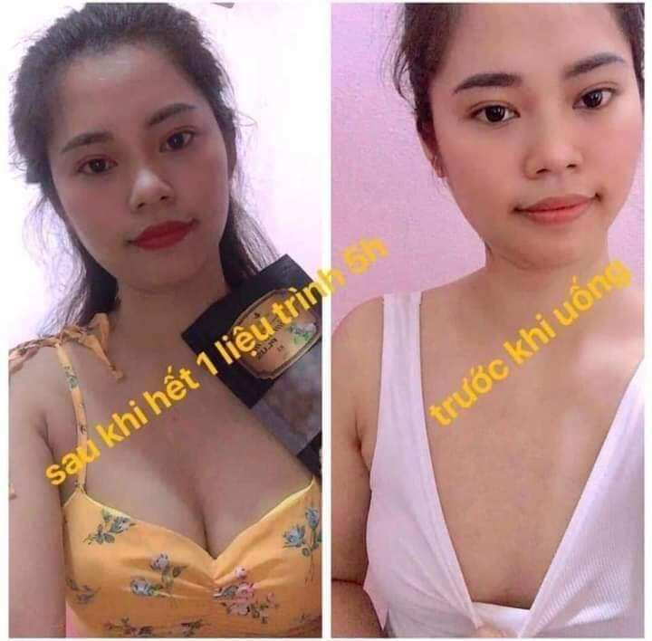 Kẹo mầm sâm tố nữ plus x2 thảo mộc 37(mua 4 hộp tặng 1 hộp nữa là 5 tặng kèm dây đo )