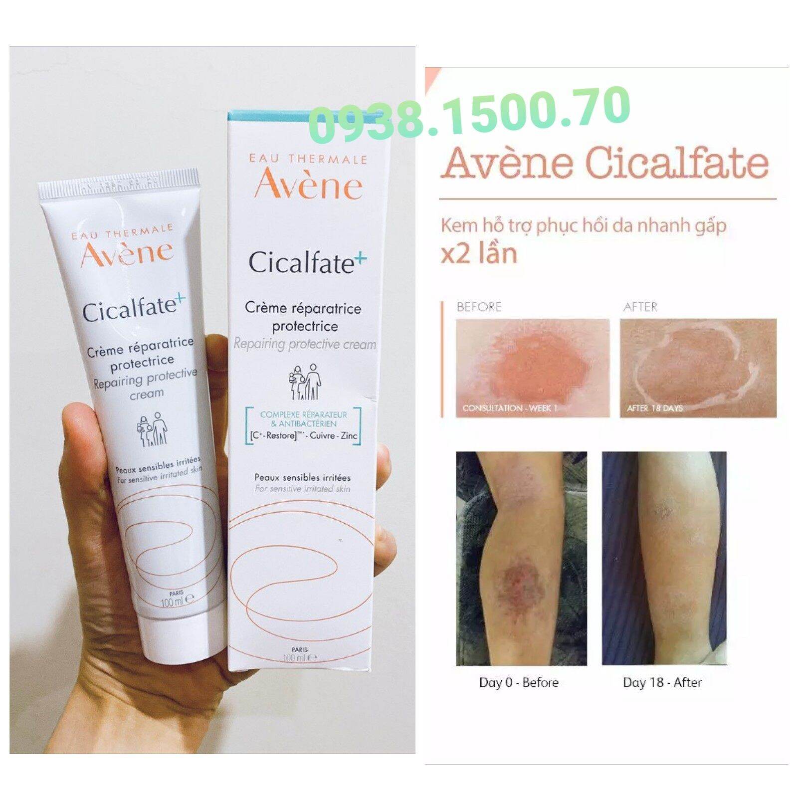 KEM PHỤC HỒI DA Avène Cicalfate Repair Cream 100ml cả t.r.ẻ s.ơ s.i.n.h