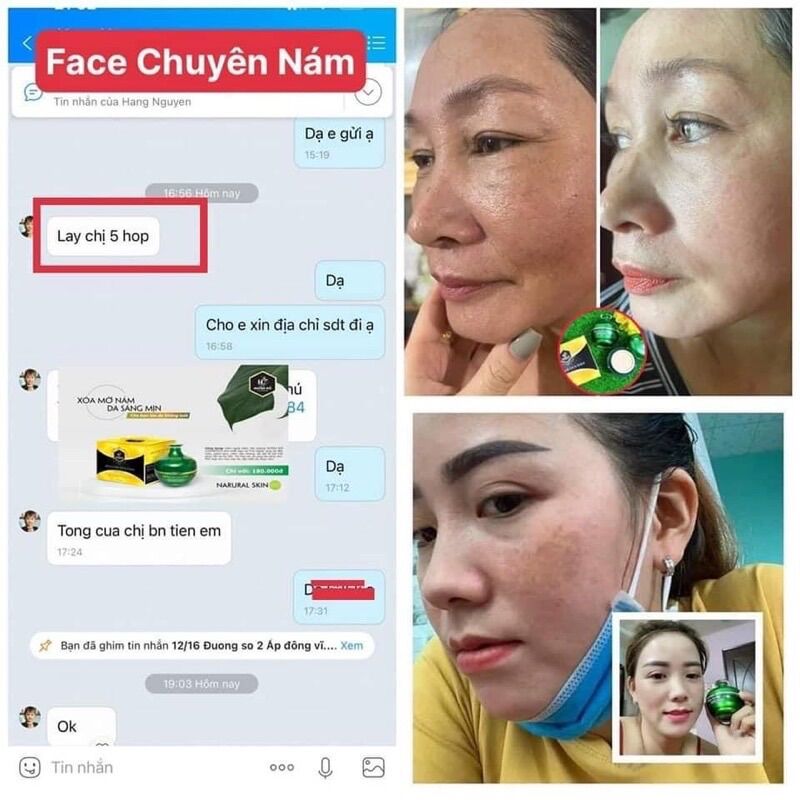 Combo chuyên nám Huỳnh Đỗ