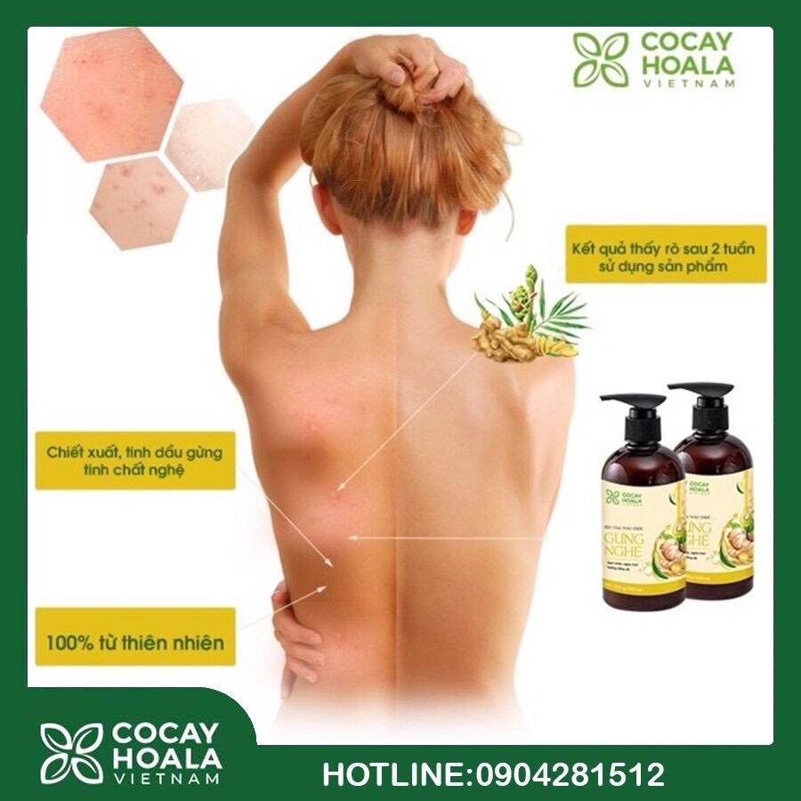 [SỈ 5 CHAI] Sữa tắm thảo dược gừng nghệ 300ml