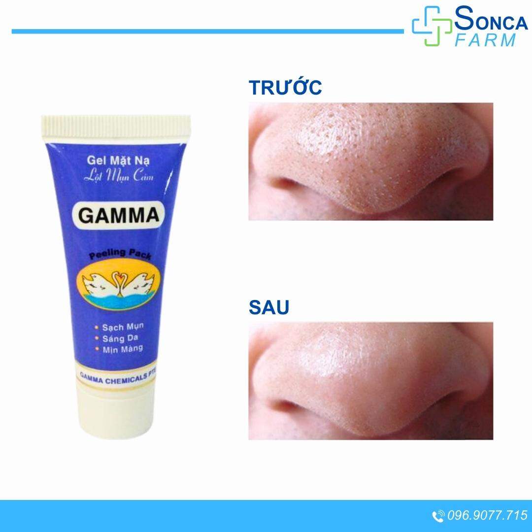 Keo Lột Mụn Đầu Đen Peeling Pack Gamma Tuýp 25g