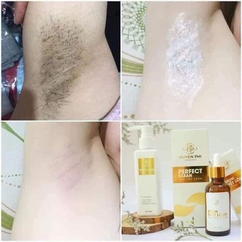 Combo kem tẩy lông và serum Huyền Phi